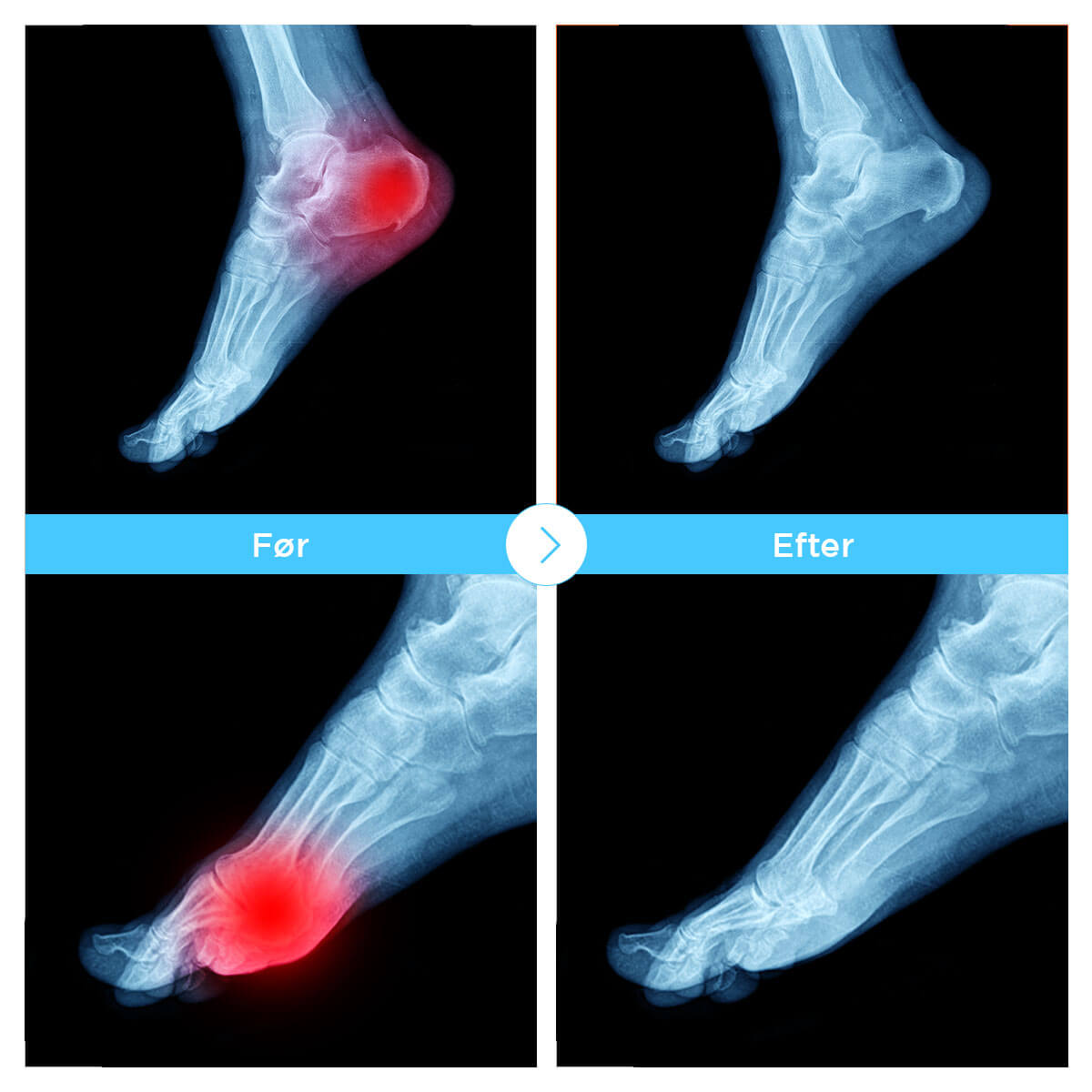 [50% rabatt] Connecty Socks™ - Dr. Neuropathy Socks 