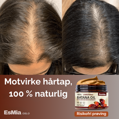 Batana™ 100% ren olje for hårvekst - 1+1 GRATIS